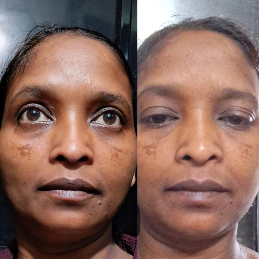 Amya, before and after