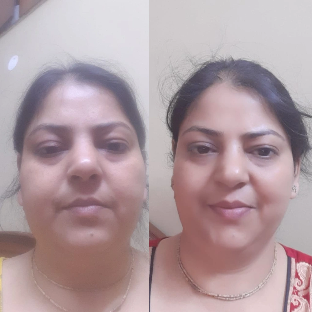 Ginni, before and after