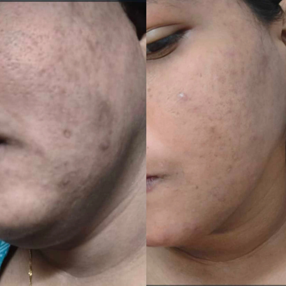 Uzma, before and after